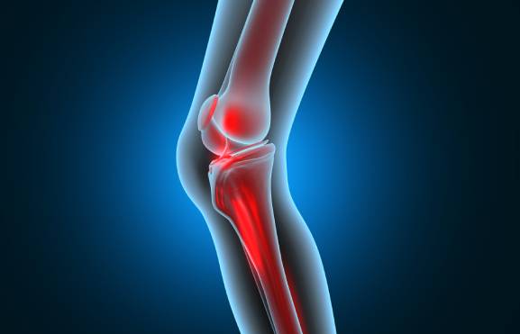 Orthopedics treatment Kanchipuram