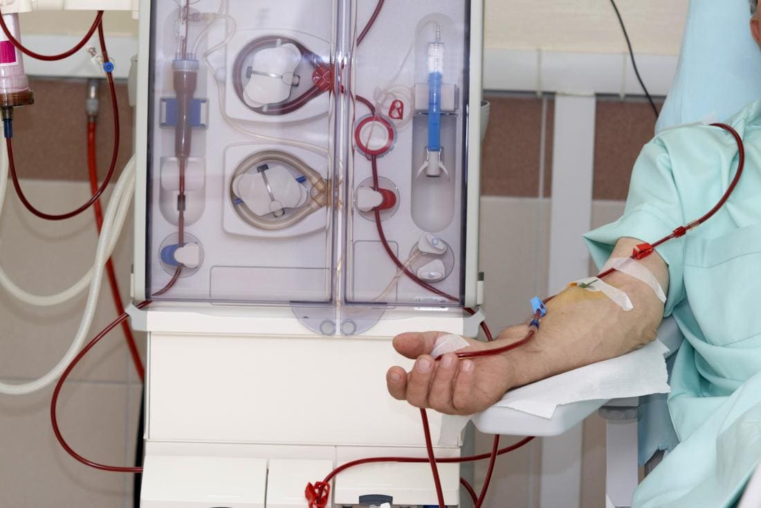 Dialysis treatment in Kanchipuram